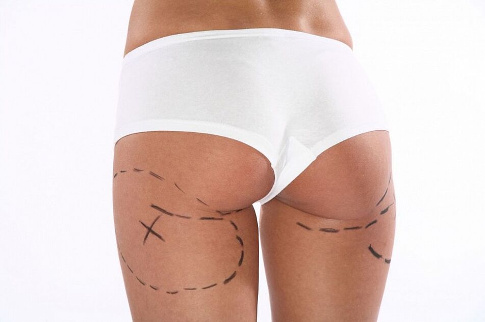 aesthetic procedures for weight loss